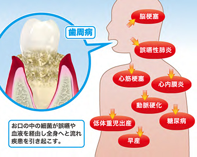 重度の歯周病にも対応する天神の歯科医