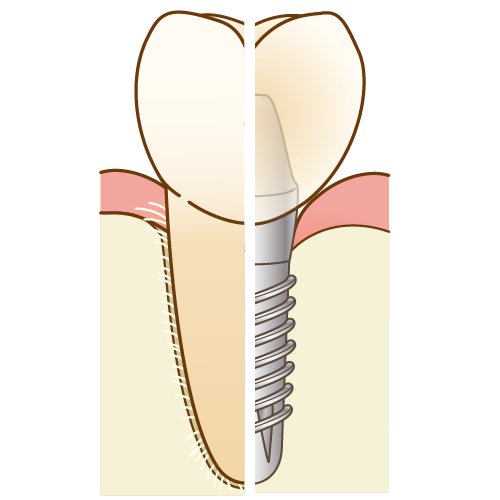インプラント専門医